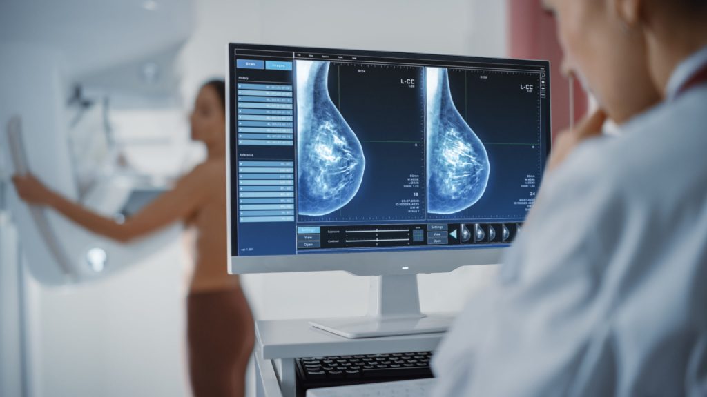 Where Will You Get a 2D Mammogram In Paterson?